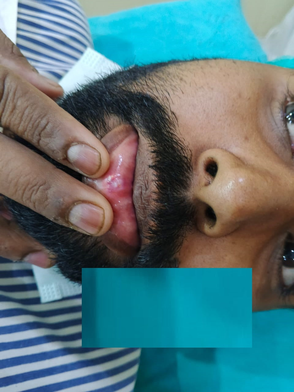 π Say Goodbye to Lip Growths with Expert Care by Dr. Tahir Kamal! π