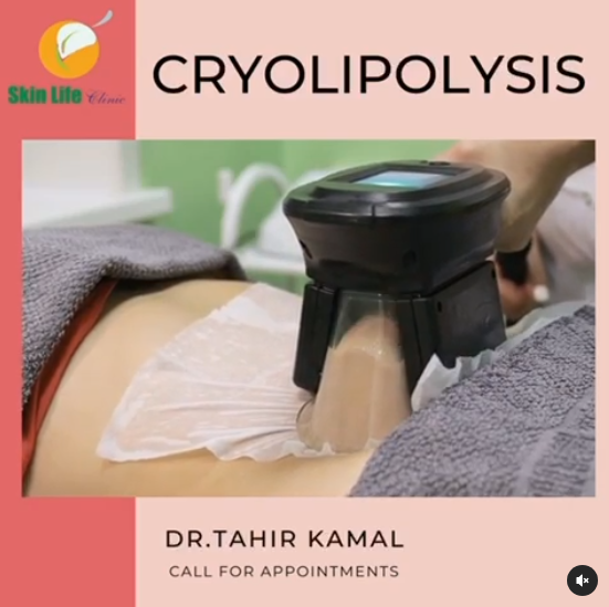 ❄️ Freeze Fat Away with Cryolipolysis at Skin Life Clinic! ❄️