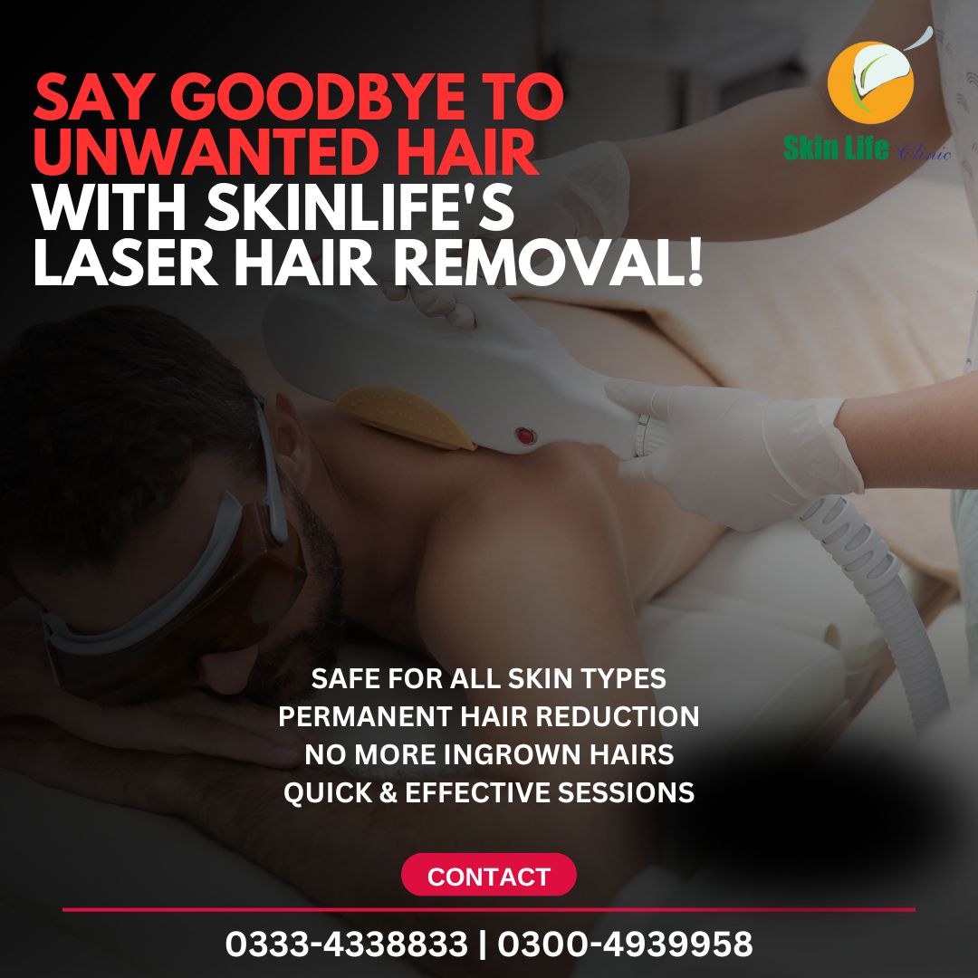 Hair Removal Laser