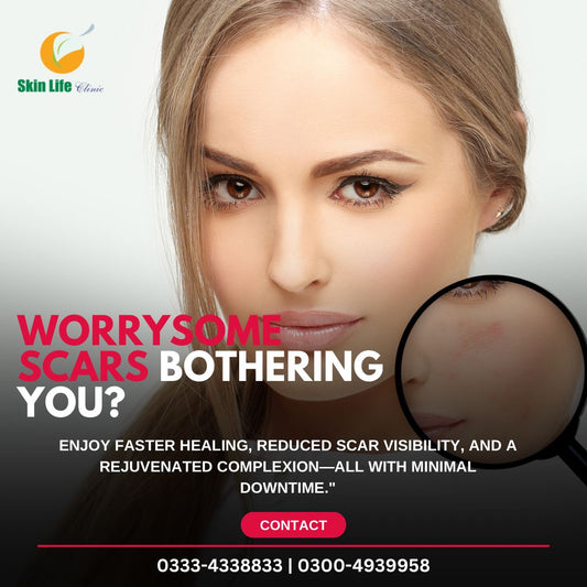 Acne Scars Removal