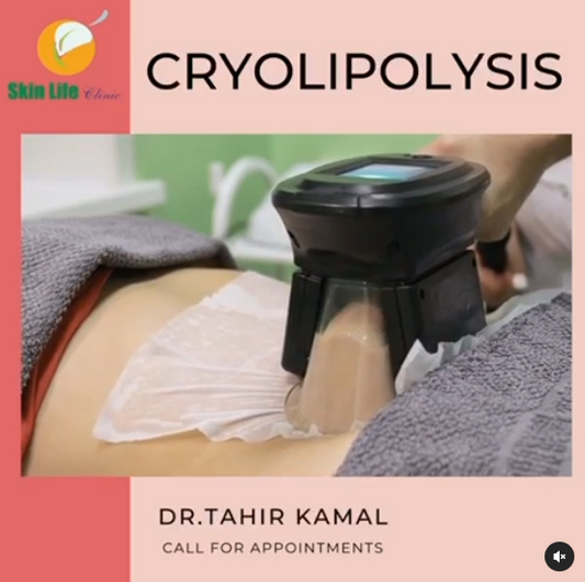 ❄️ Freeze Fat Away with Cryolipolysis at Skin Life Clinic! ❄️