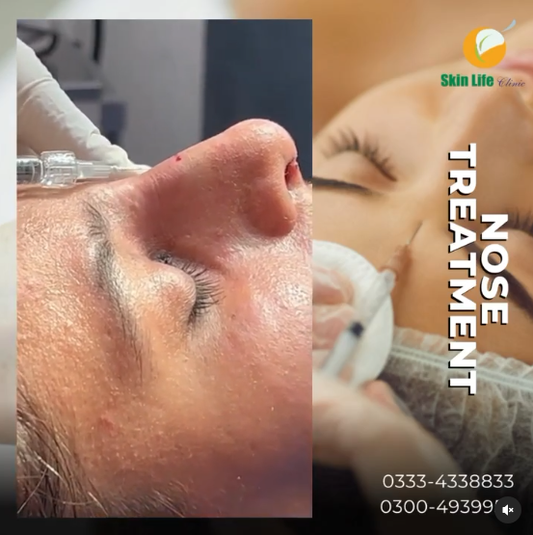 🌟 Transform Your Nose with Non-Surgical Rhinoplasty at Skin Life Clinic! 🌟