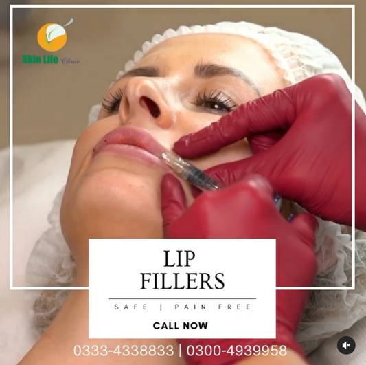 🌟 Enhance Your Smile with Lip Fillers at Skin Life Clinic! 🌟