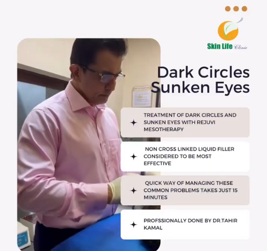 🌟 Say Goodbye to Dark Circles with Dr. Tahir Kamal at Skin Life Clinic! 🌟