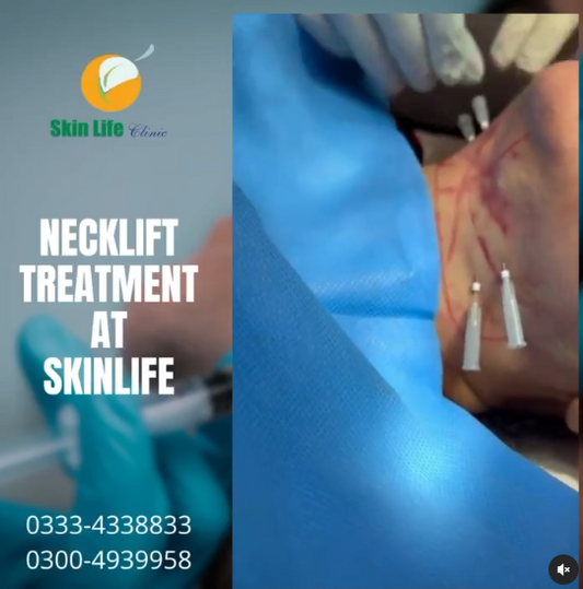 ✨ Neck Lift Treatment with Dr. Tahir Kamal at Skin Life Clinic ✨