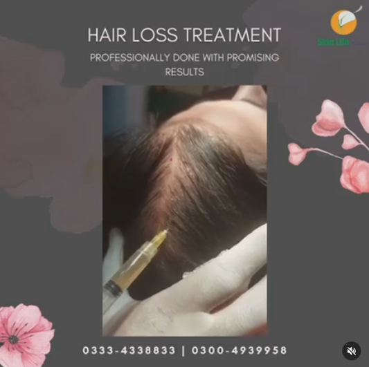 🌟 Reclaim Your Confidence with Hair Loss Treatments at Skin Life Clinic! 🌟