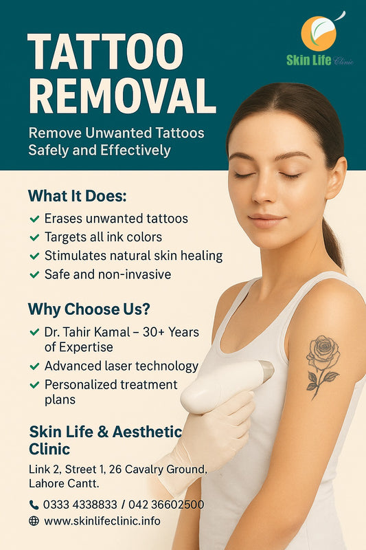 Tattoo Removal – Clear Skin, Fresh Start