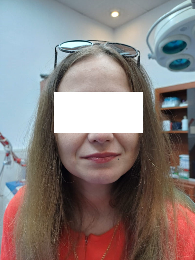 Lip Enhancement