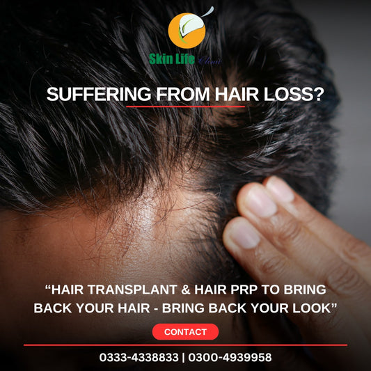 Hair Transplant