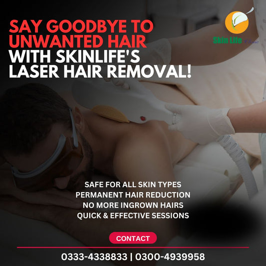 Hair Removal Laser