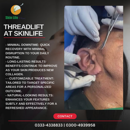 Non-Surgical Facelift with Threads by Dr. Tahir Kamal