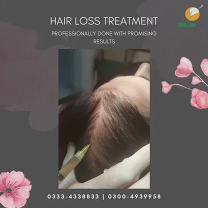 🌟 Reclaim Your Confidence with Hair Loss Treatments at Skin Life Clinic! 🌟