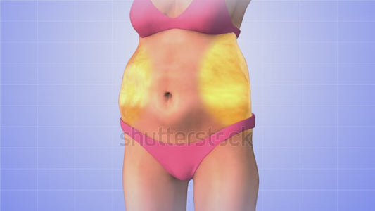 🔥 Say Goodbye to Stubborn Belly Fat – Non-Surgical Lipo Magic! 🔥