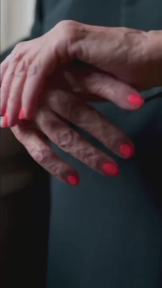 💎 Rejuvenate Aging Hands with Expert Care by Dr. Tahir Kamal at Skin Life Clinic! 💎