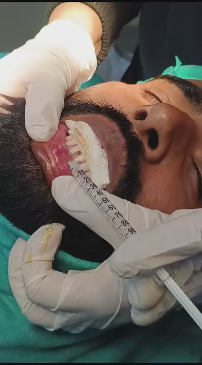 🌟 Say Goodbye to Lip Growths with Expert Care by Dr. Tahir Kamal! 🌟