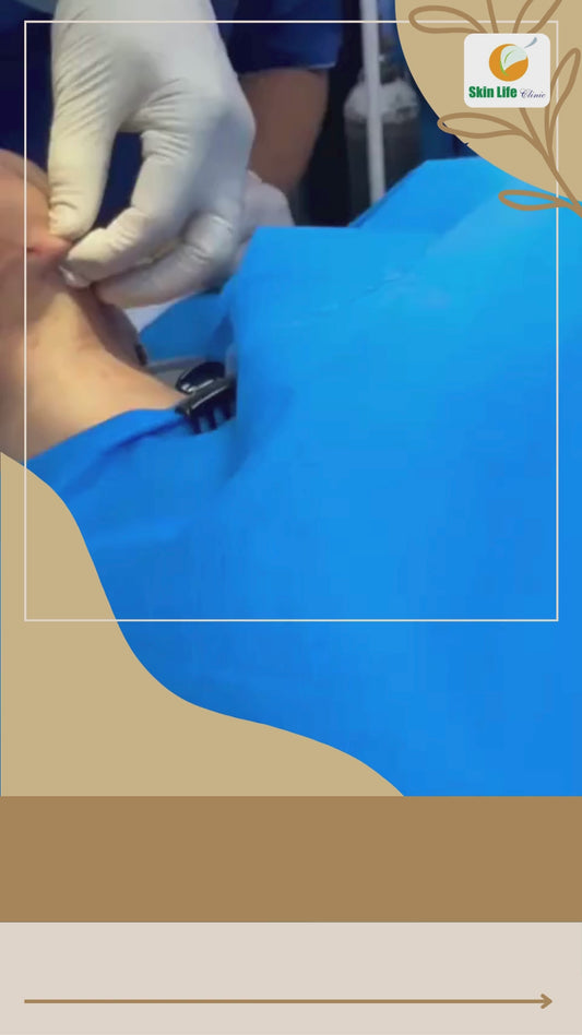 🎥 Transforming the Neck & Face – Threads, Filler & Botox in Action!