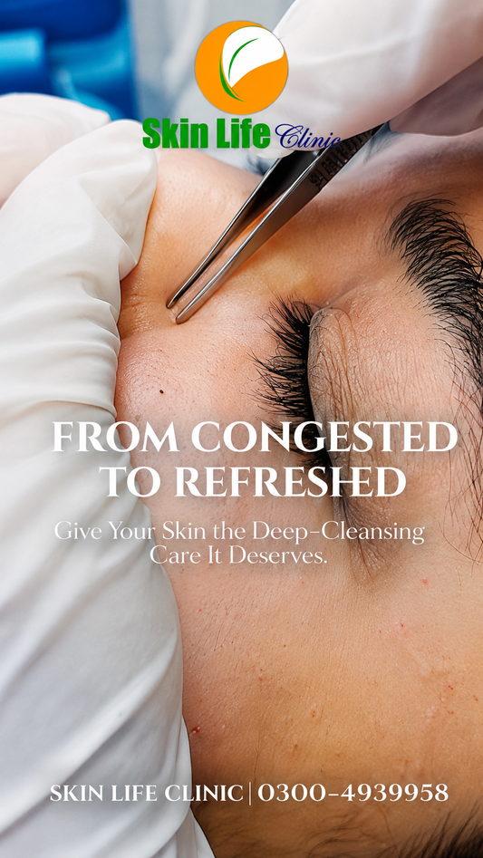 From Congested to Refreshed
