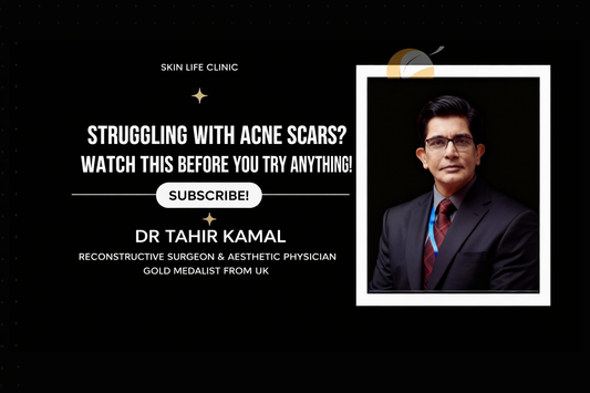 Struggling with Acne Scars? Read This Before You Try Any Treatment