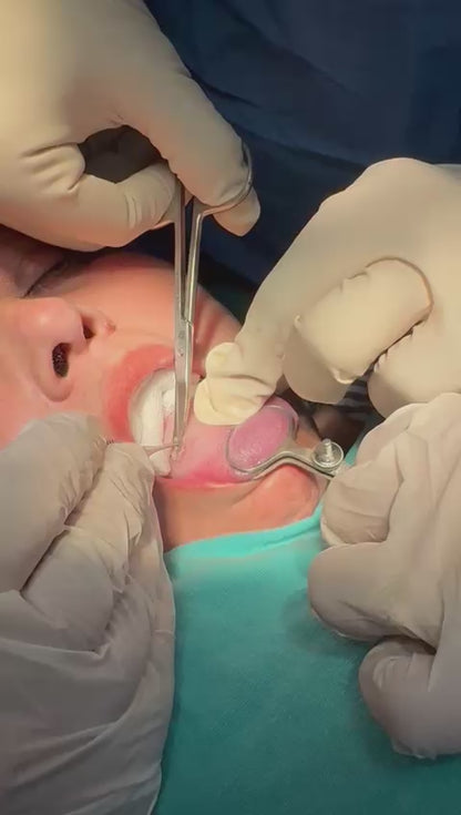 Effective Treatment for Vascular Growth on Tongue by Dr. Tahir Kamal